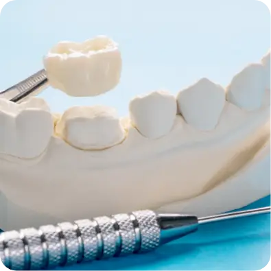 Cosmetic Dentistry graphic of a tooth model and crown